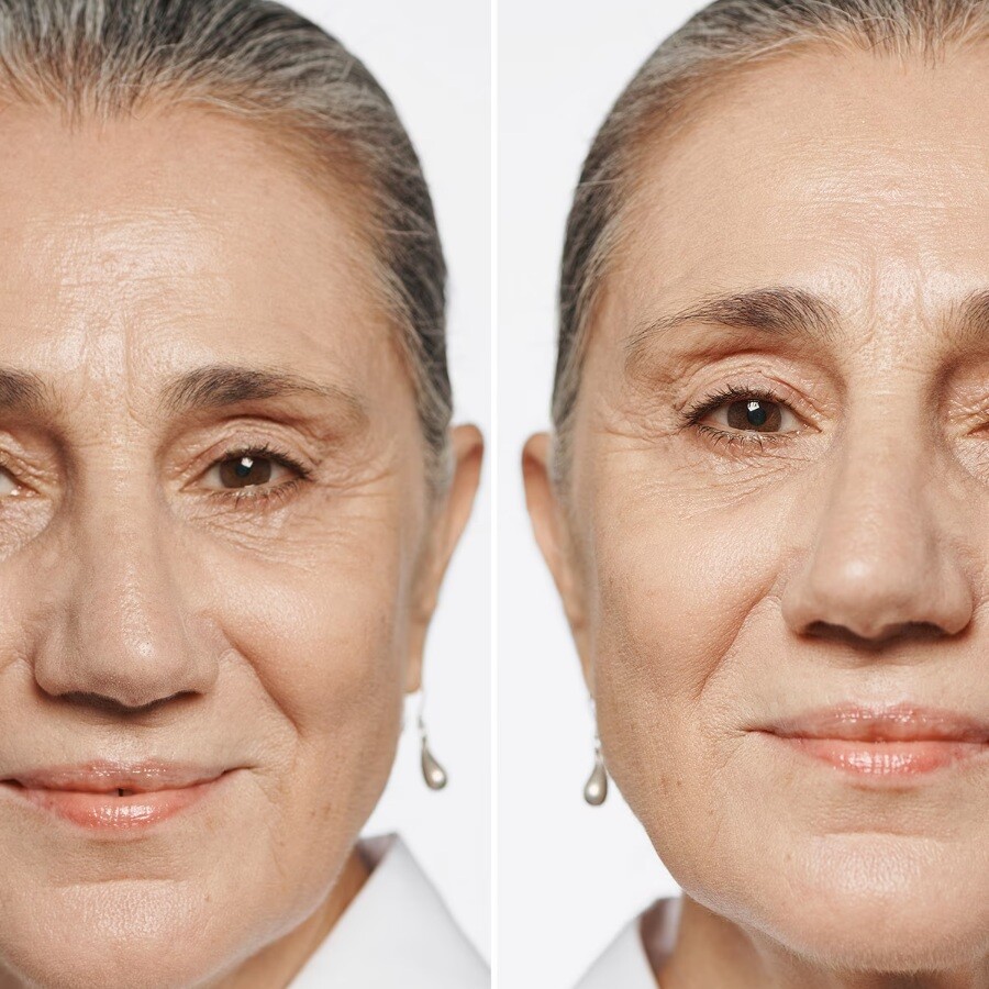 Тональная основа под макияж Clinique, Even Better SPF 15, 30 мл, CN 10 Alabaster
Тональная основа под макияж Clinique, Even Better SPF 15, 30 мл, CN 10 Alabaster