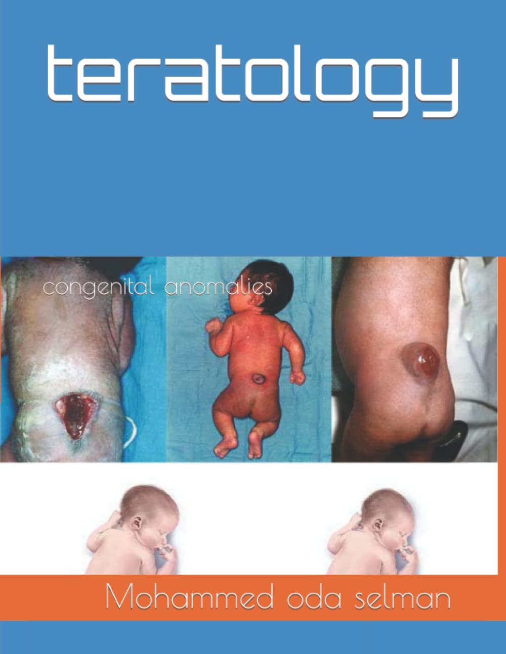 teratology: congenital anomalies (Independently published)
teratology: congenital anomalies (Independently published)