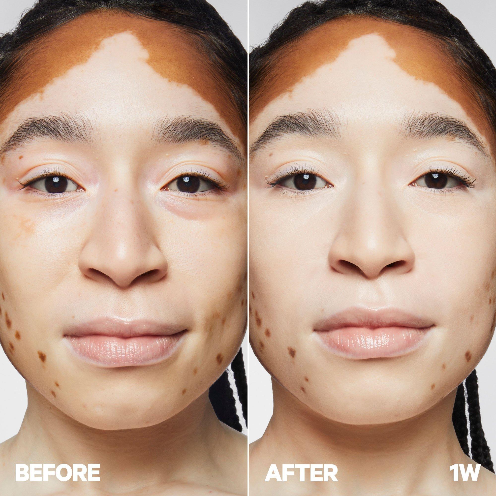Увлажняющий консилер Future Fluid Longwear с гиалуроновой кислотой MILK MAKEUP, 1W (very fair with warm undertones)
Увлажняющий консилер Future Fluid Longwear с гиалуроновой кислотой MILK MAKEUP, 1W (very fair with warm undertones)