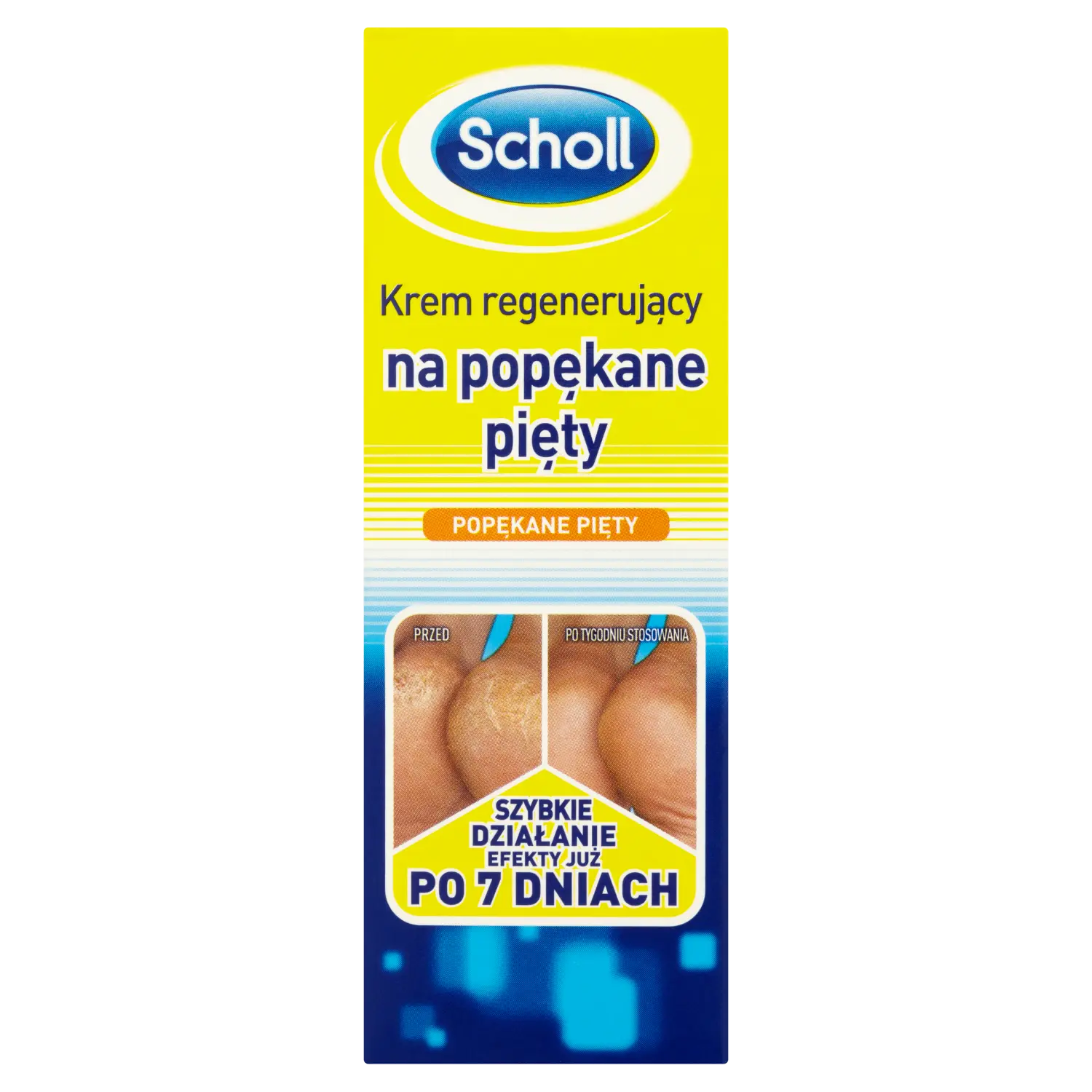 Scholl регенерирующий крем от трещин на пятках, 60 мл
Scholl регенерирующий крем от трещин на пятках, 60 мл