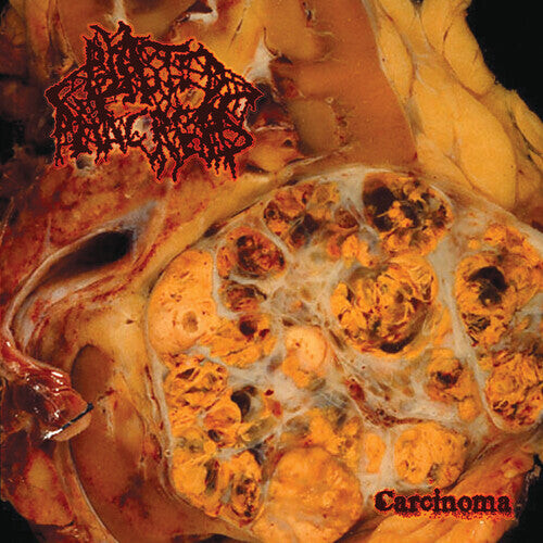 Виниловая пластинка Blasted Pancreas: Carcinoma
Виниловая пластинка Blasted Pancreas: Carcinoma
