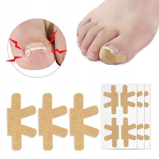 Пластыри для вросших ногтей на ногах, полоски-пряжки, 4 шт. FootService