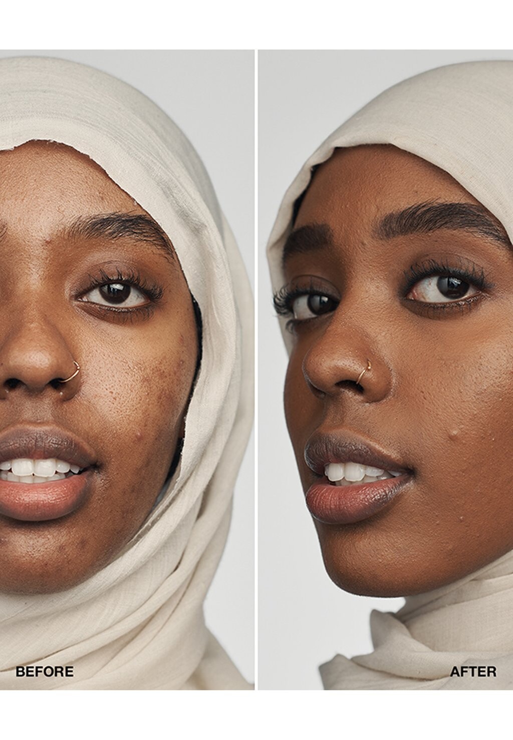 Тональное средство EVEN BETTER CLINICAL SERUM FOUNDATION SPF20 Clinique, цвет Cn 116 Spice
Тональное средство EVEN BETTER CLINICAL SERUM FOUNDATION SPF20 Clinique, цвет Cn 116 Spice