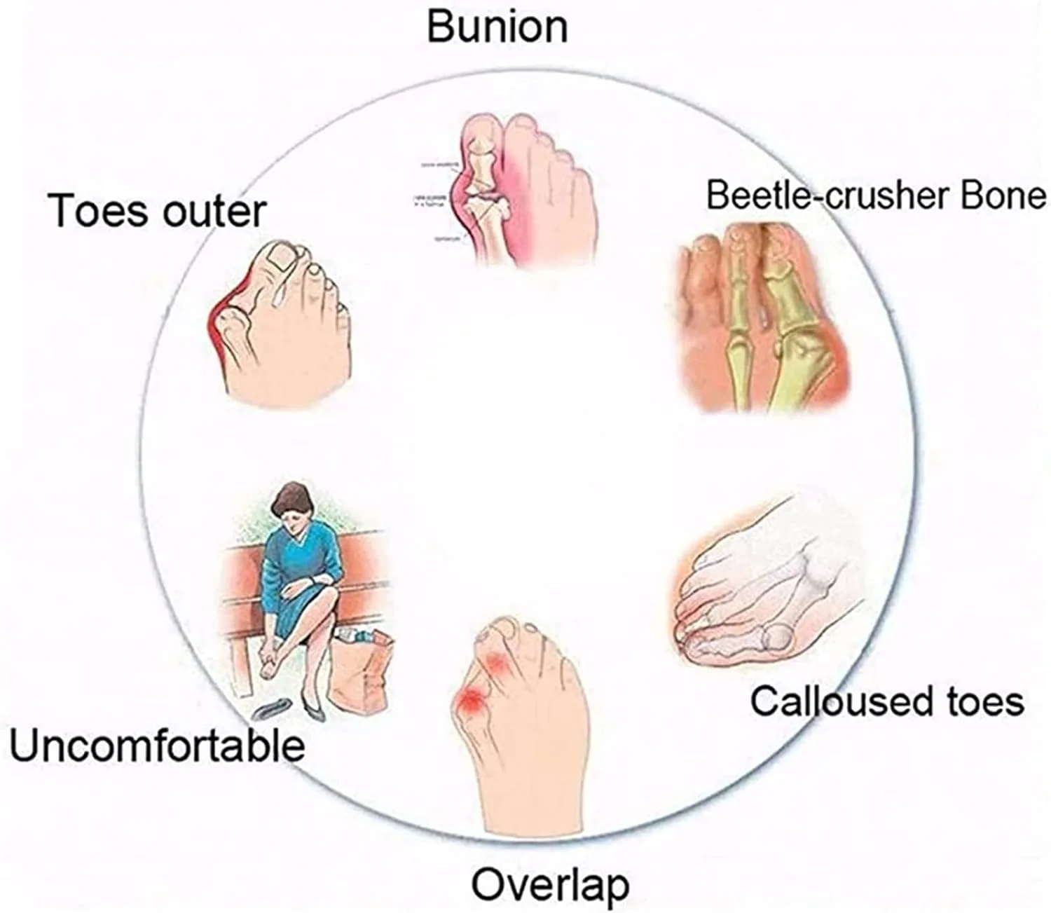 Летние сандалии для коррекции стопы, уличная модная дышащая ортопедическая обувь для мозолей для мужчин, повседневные легкие шлепанцы для ходьбы с корректировкой пальцев, для подошвенного фасциита WCXTY, коричневый
Летние сандалии для коррекции стопы, уличная модная дышащая ортопедическая обувь для мозолей для мужчин, повседневные легкие шлепанцы для ходьбы с корректировкой пальцев, для подошвенного фасциита WCXTY, коричневый
