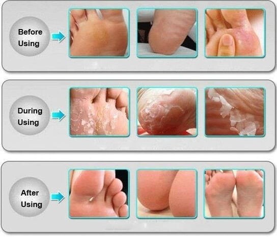 Отшелушивающие носки для ног Topshine
Отшелушивающие носки для ног Topshine