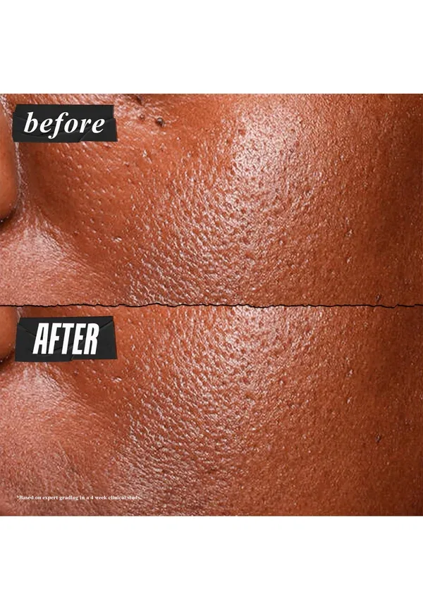 Ультрачистая высокоэффективная сыворотка с 5% ниацинамидом - сыворотка 30 мл Kiehl'S — фото 3