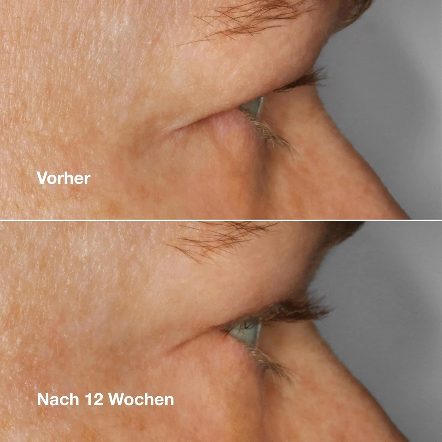Питательная сыворотка для ресниц «High Impact Lash Amplifying Serum» от Clinique Clinique — фото 4