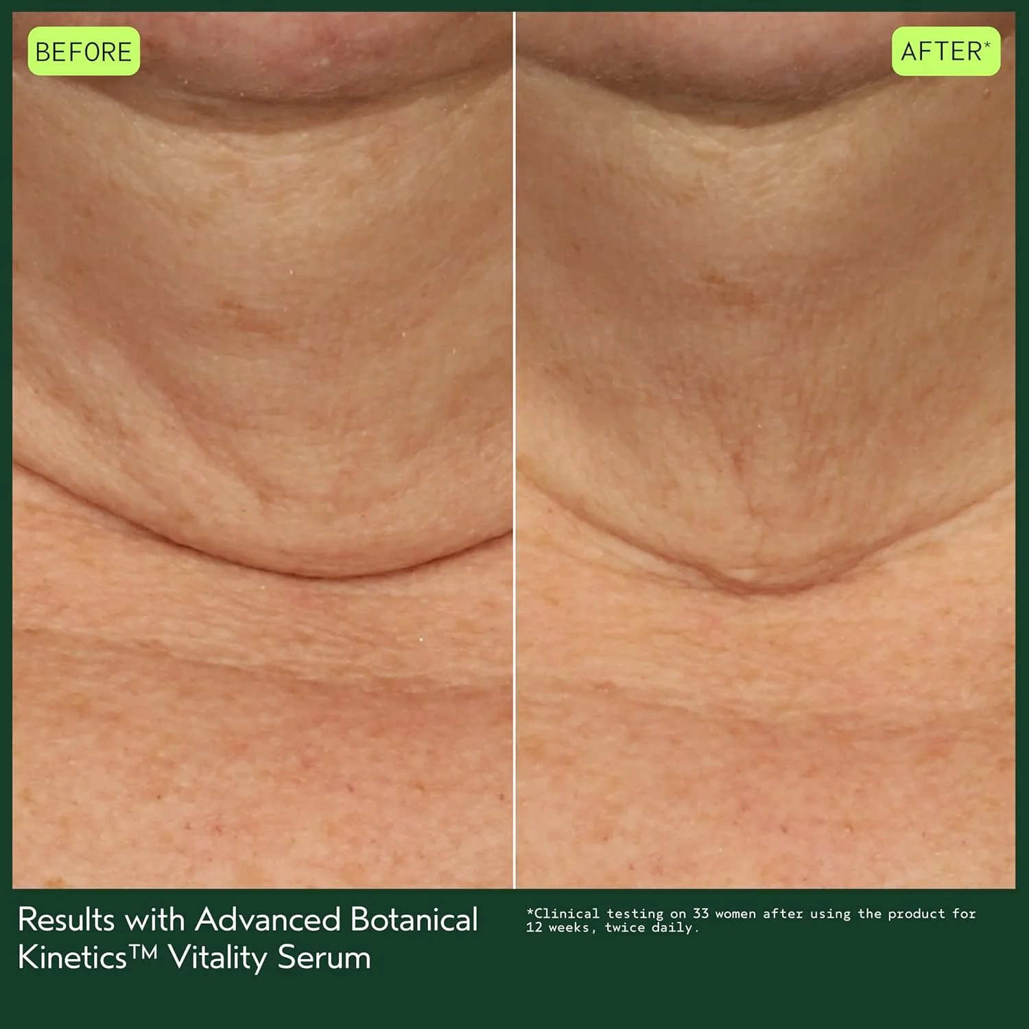 Сыворотка Aveda — Для повышения жизненной энергии Advanced Botanical Kinetics Vitality Serum | Уменьшает, 30 мл — фото 4