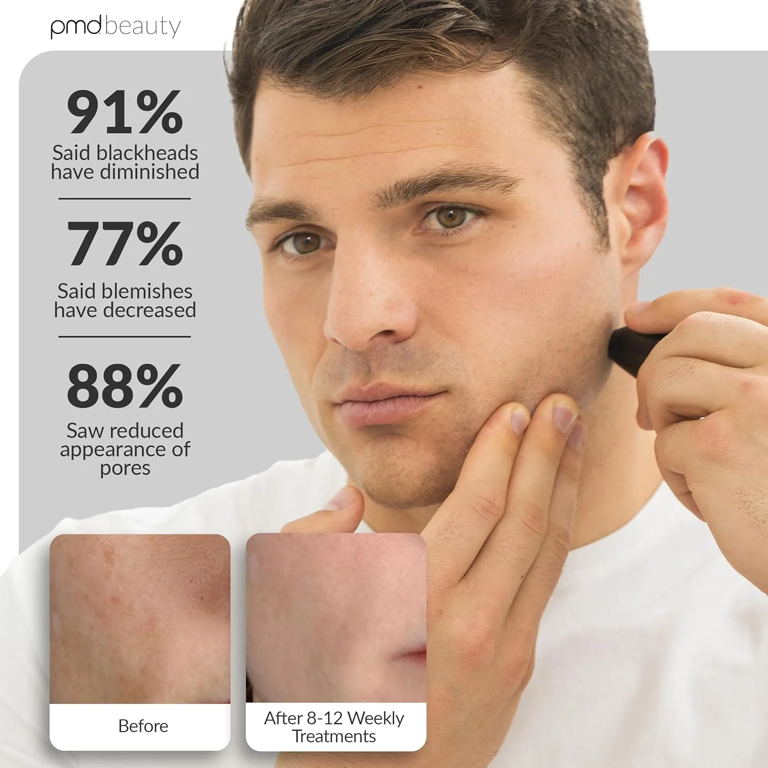 PMD Beauty Personal Microderm Man - Домашний аппарат для микродермабразии с набором для лица и тела - Отшелушивающие кристаллы и вакуумное всасывание для сияющей и эффектной кожи, Black — фото 4