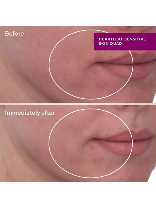 Сыворотка Murad — Мягкая для обновления кожи Heartleaf, 30 мл — фото 2