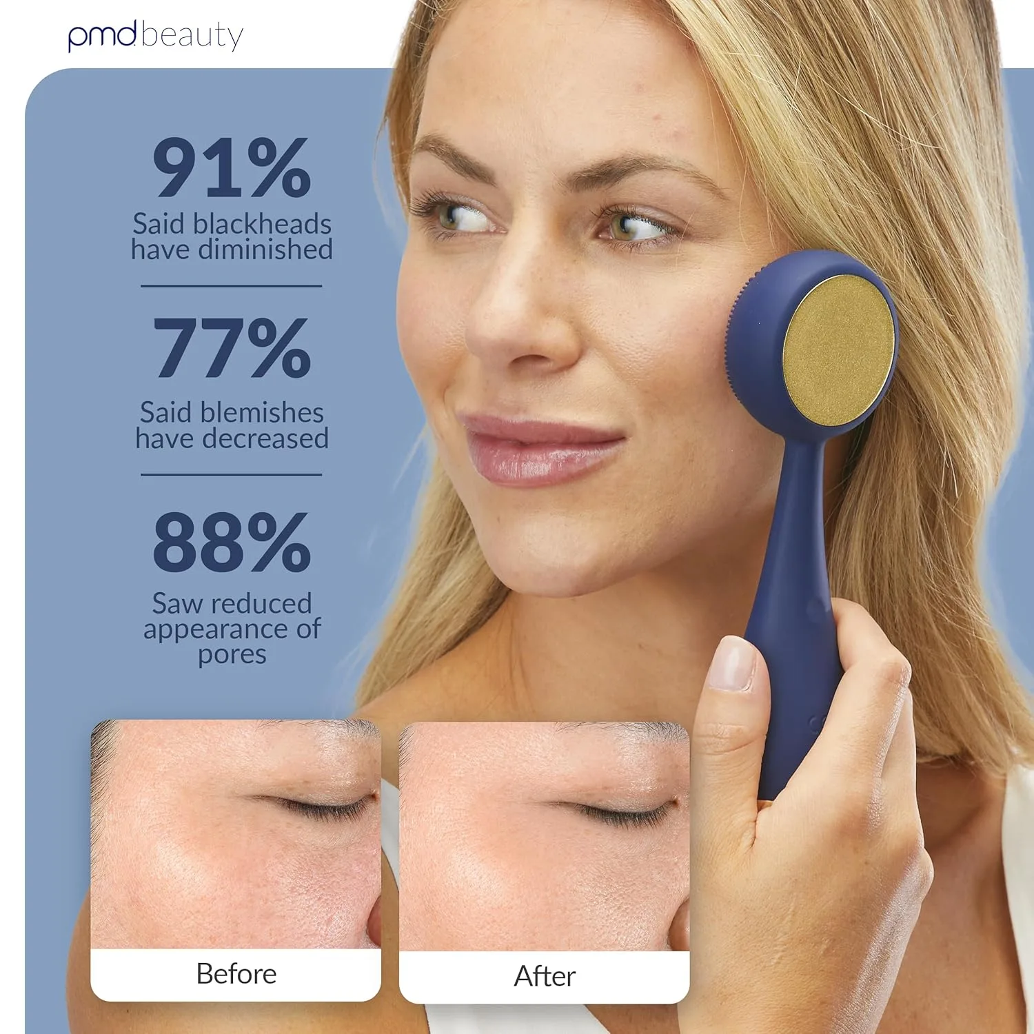 Clean Pro OB - Интеллектуальное устройство для очищения лица Pmd Beauty, Navy — фото 4