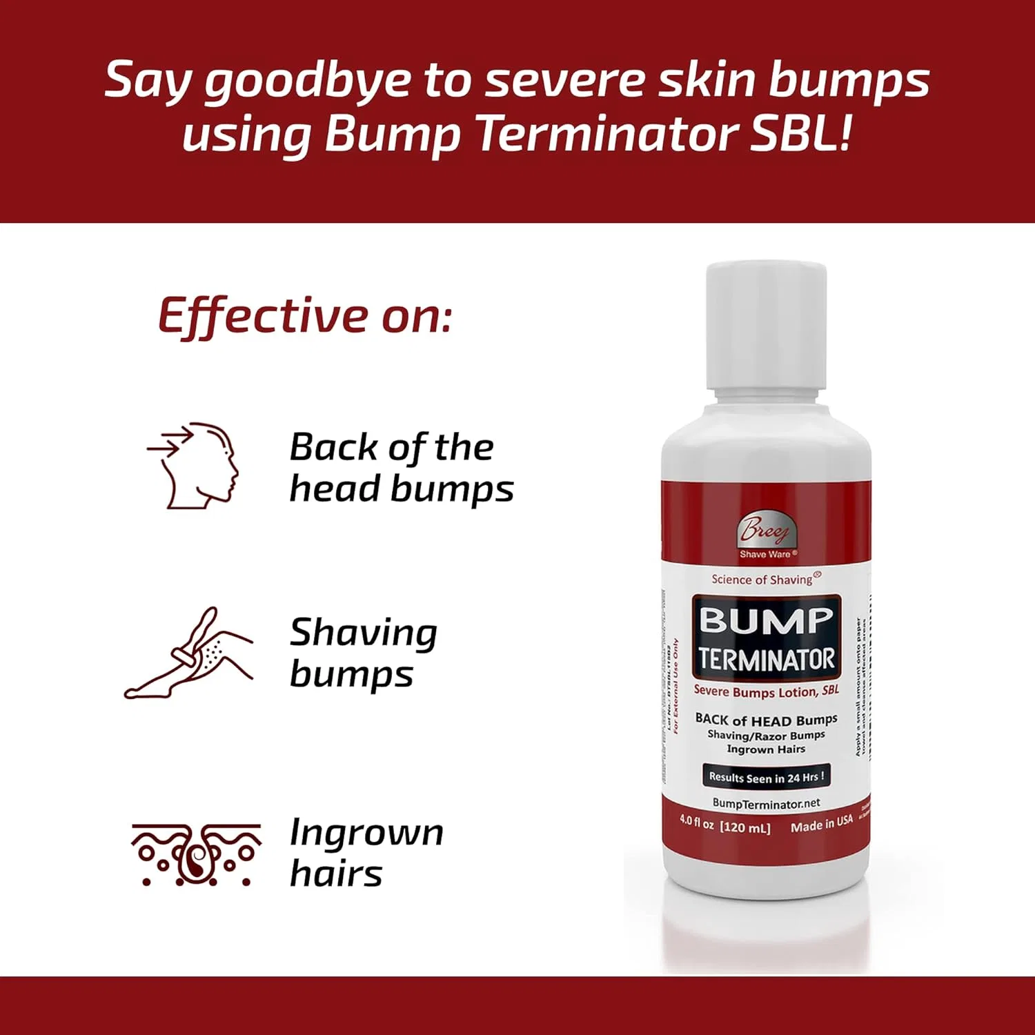 Лосьон от шишек Bump Terminator Severe Bumps, 120 мл, BREEJ — фото 3