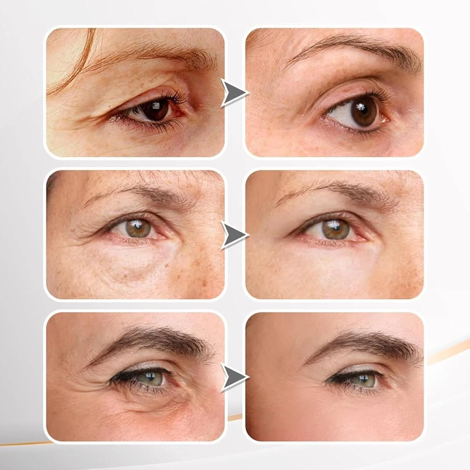 Гель для глаз Youthful Lift Firming Cream, 100 г Generisch — фото 4