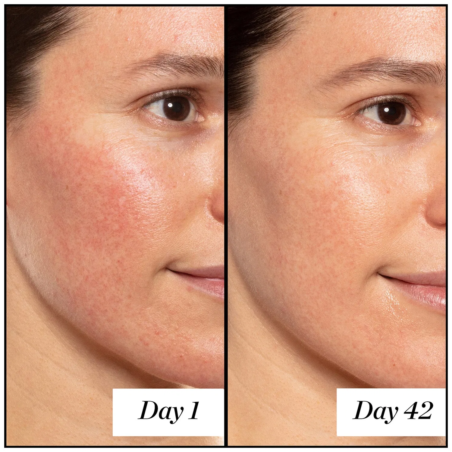 Сыворотка для лица с ретинолом A+ High-Dose Retinoid Serum Sunday Riley, 50 мл — фото 4