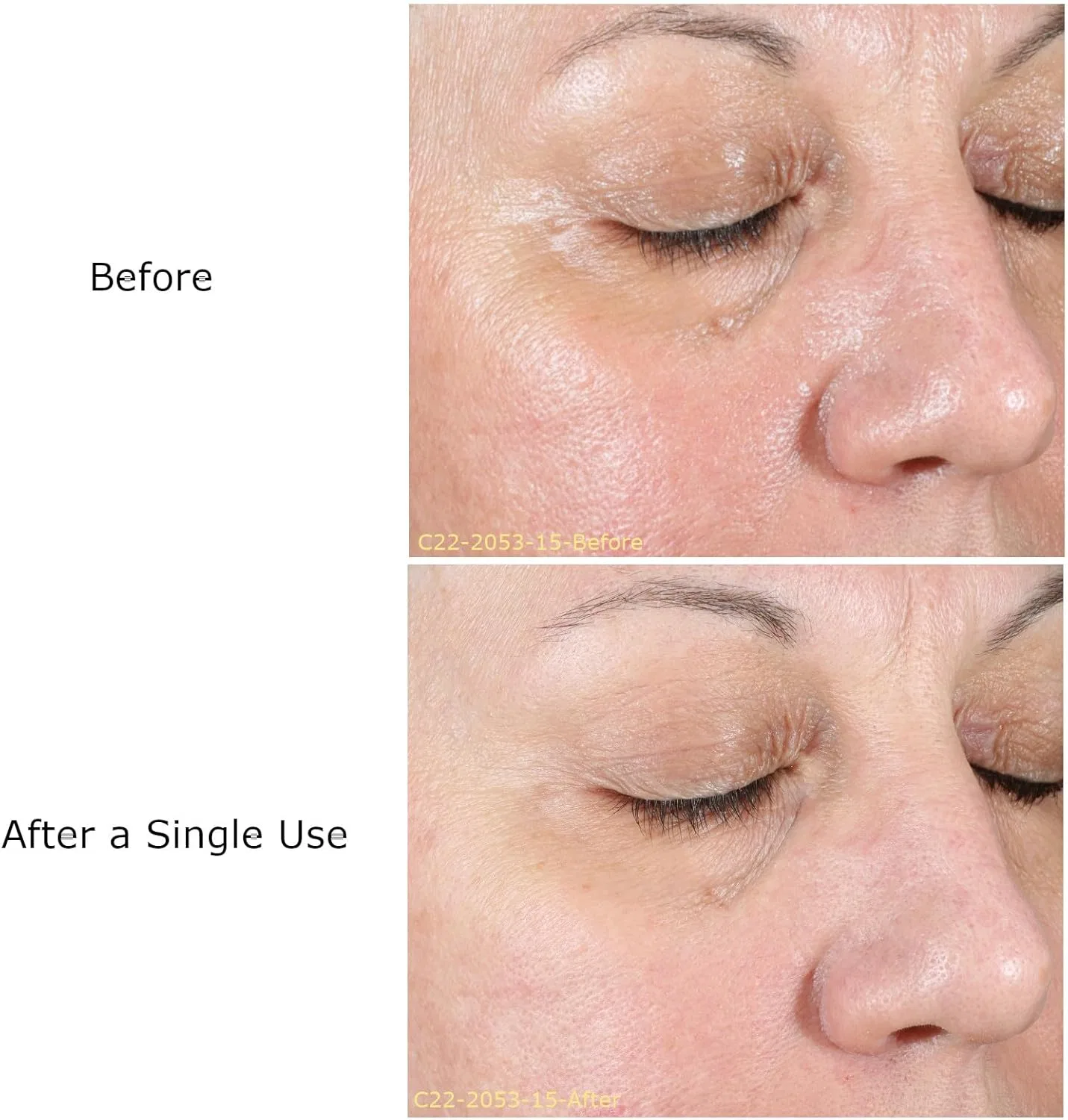 Набор для ухода за кожей AHA Refresh Facial от OPULUS Beauty Labs, 3.5 недели — фото 2