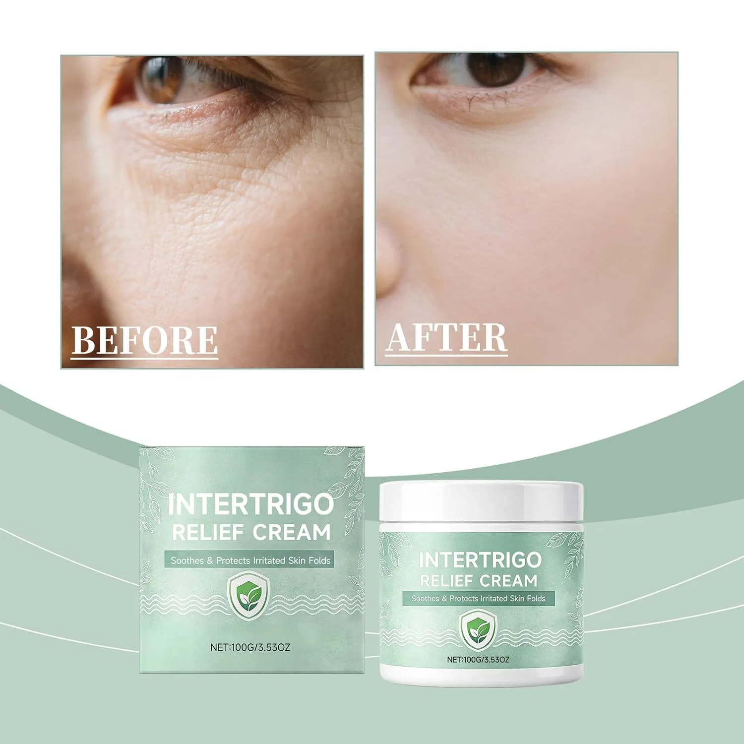 Крем для защиты кожи от раздражения SKZKK Healora Intertrigo Cream, 100г, 12 шт — фото 2