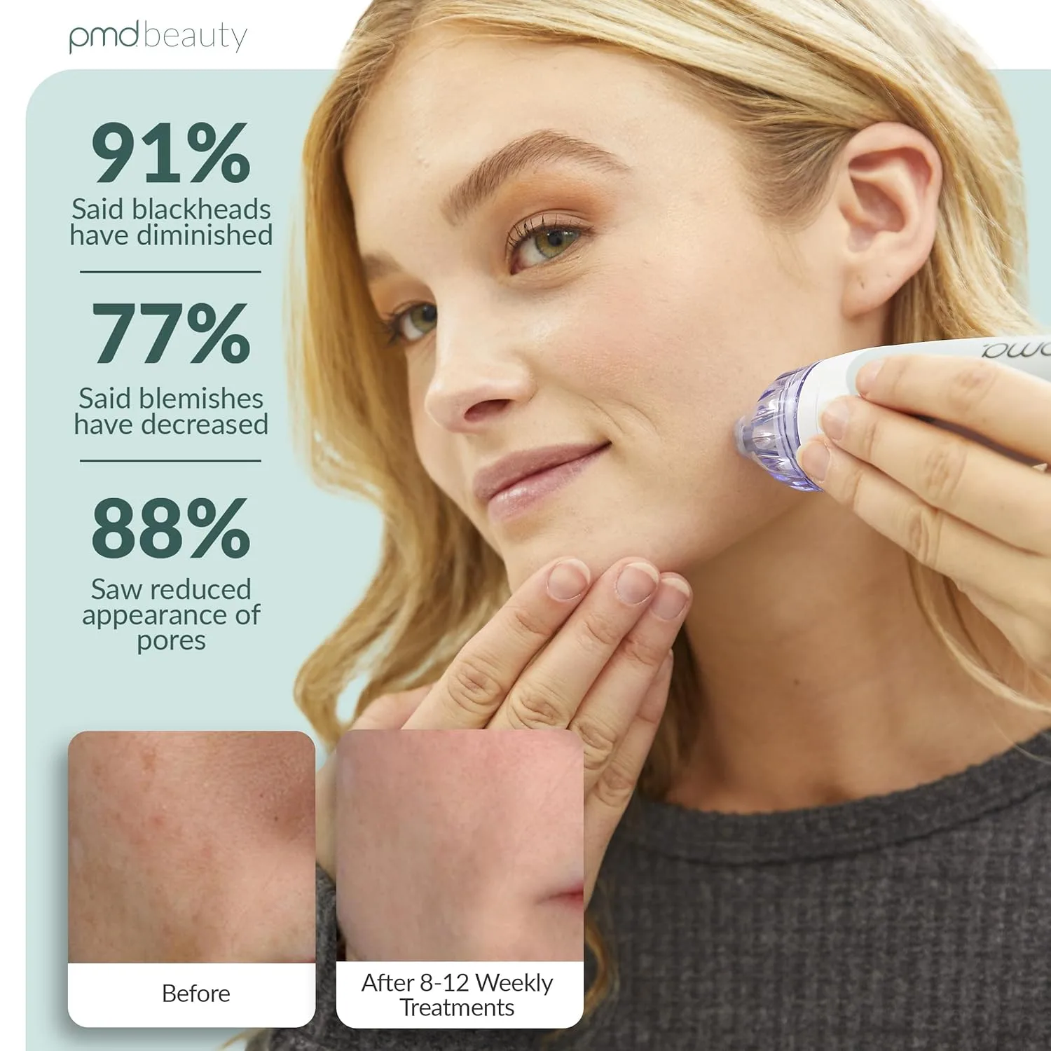 PMD Beauty Personal Microderm Classic - Набор для домашнего использования, инструмент для отшелушивания кожи лица, микродермабразия для ухода за кожей лица и тела., Grey — фото 3