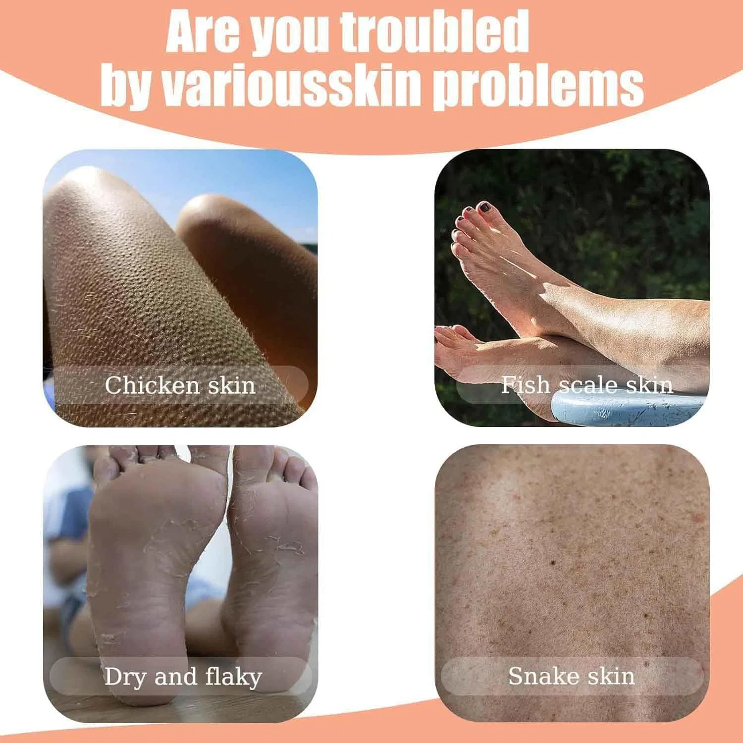 Скраб — Для лечения «клубничной кожи» Strawberry Skin Treatment, . Generisch, 118 мл — фото 2