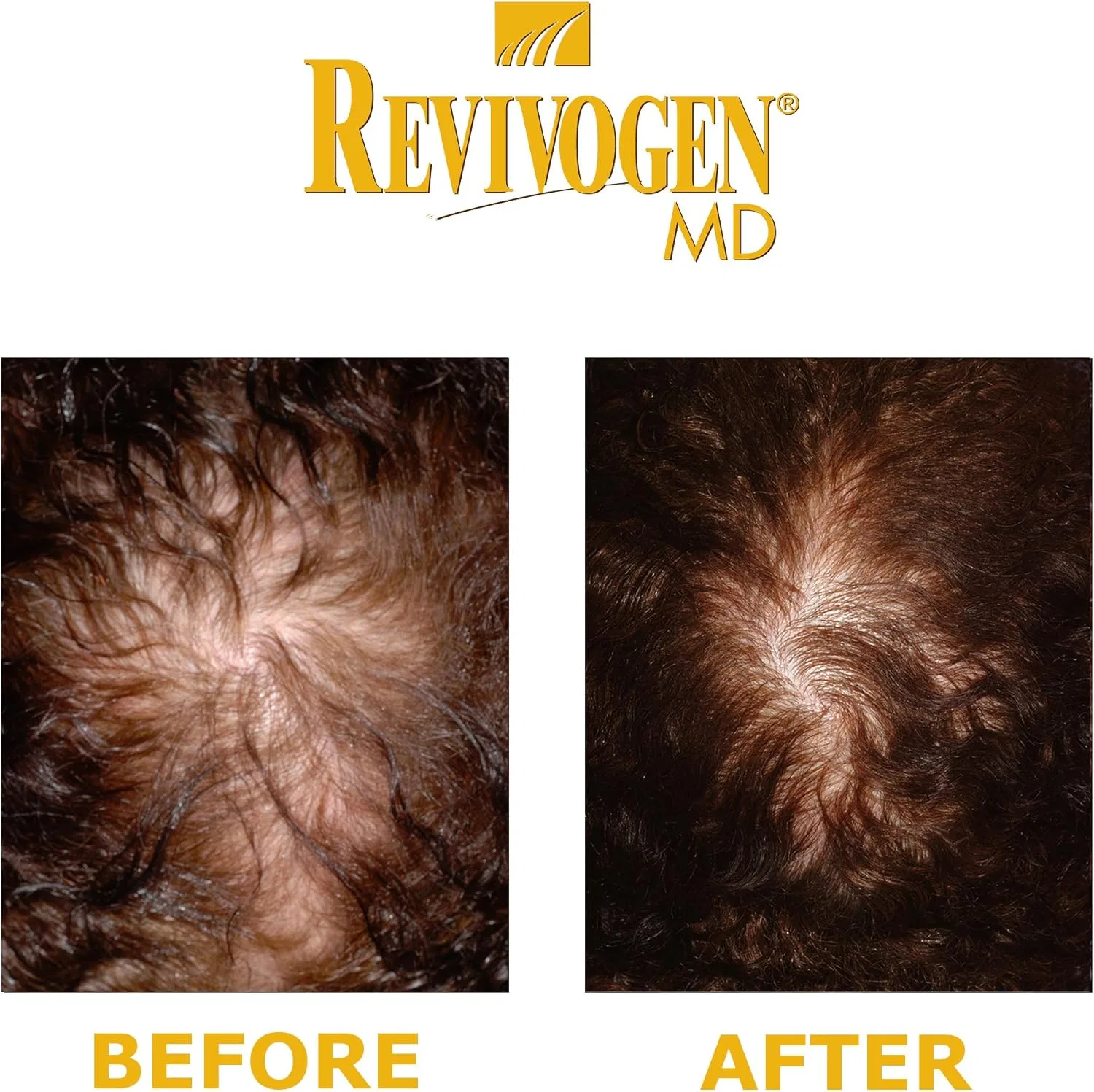 Средство для кожи головы REVIVOGEN MD Scalp Therapy для тонких и редеющих волос Revivogen — фото 2