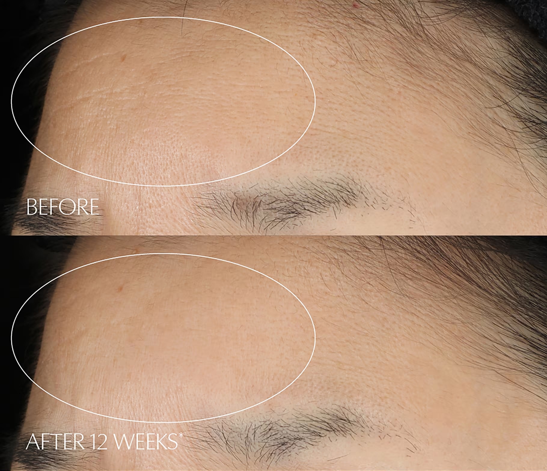 Сыворотка Estée Lauder — Для лица Estee Advanced Night Repair Multi-Recovery, 75 мл — фото 3
