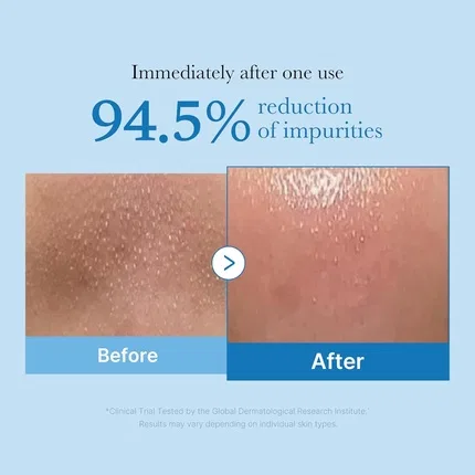 Гидрофильное масло для снятия макияжа Medicube Zero Pore Blackhead Cleansing Oil