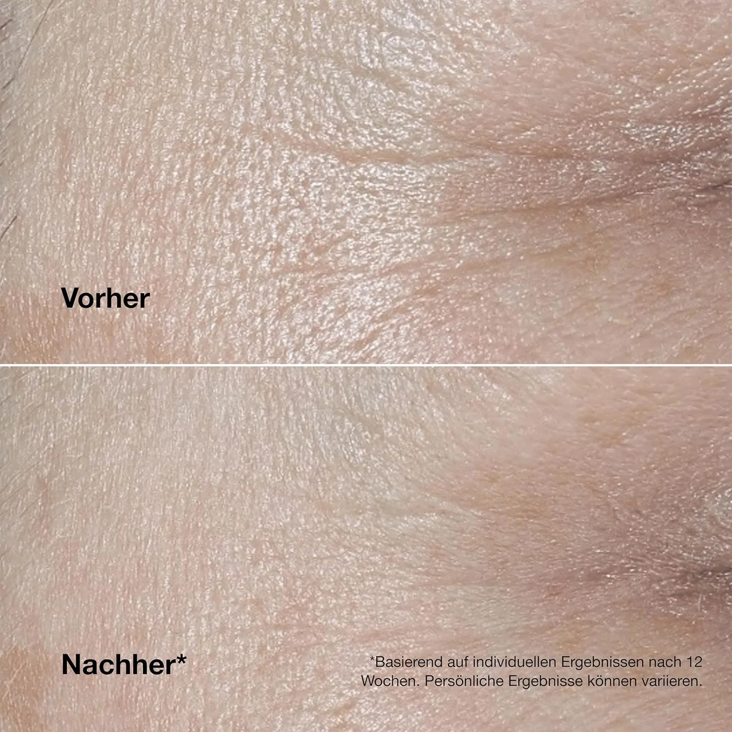 Крем для лица SPF CLINIQUE Антивозрастной «Smart Clinical Repair» от — фото 4
