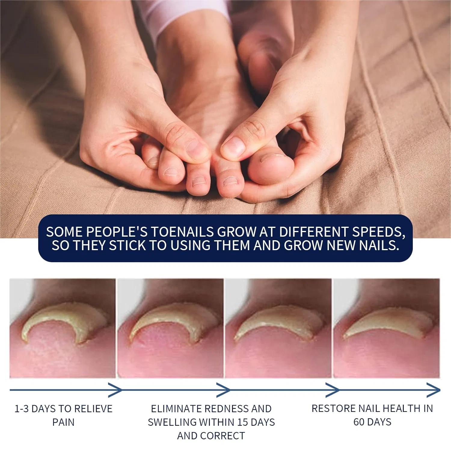 Масло German Toenailcare Removal Paronychia Oil для ухода за ногтями, 10 мл Sovtay, 1Pcs — фото 4