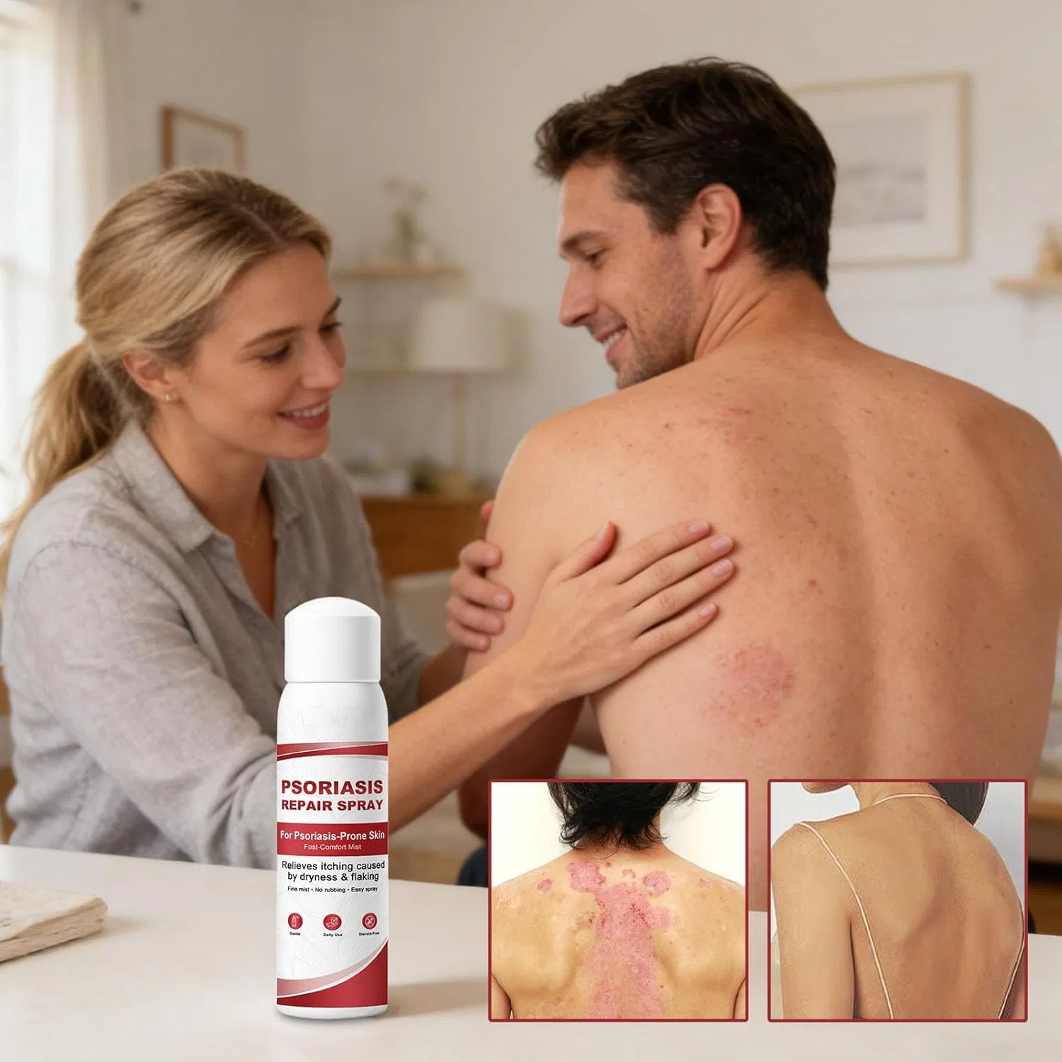 Восстанавливающий спрей для тела «Skin Repair Spray» Generisch — фото 2