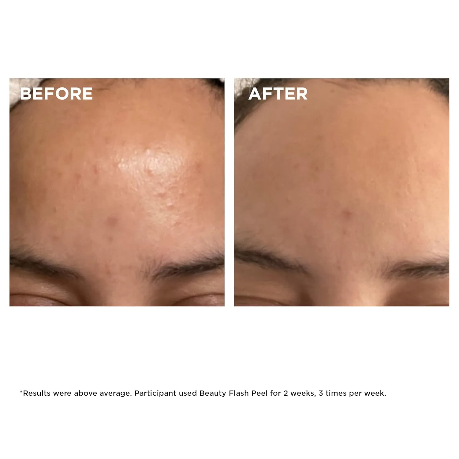 Пилинг Clarins — Beauty Flash Peel: -минутная домашняя процедура для сужения пор, удаления омертвевших, 48.2 г — фото 3
