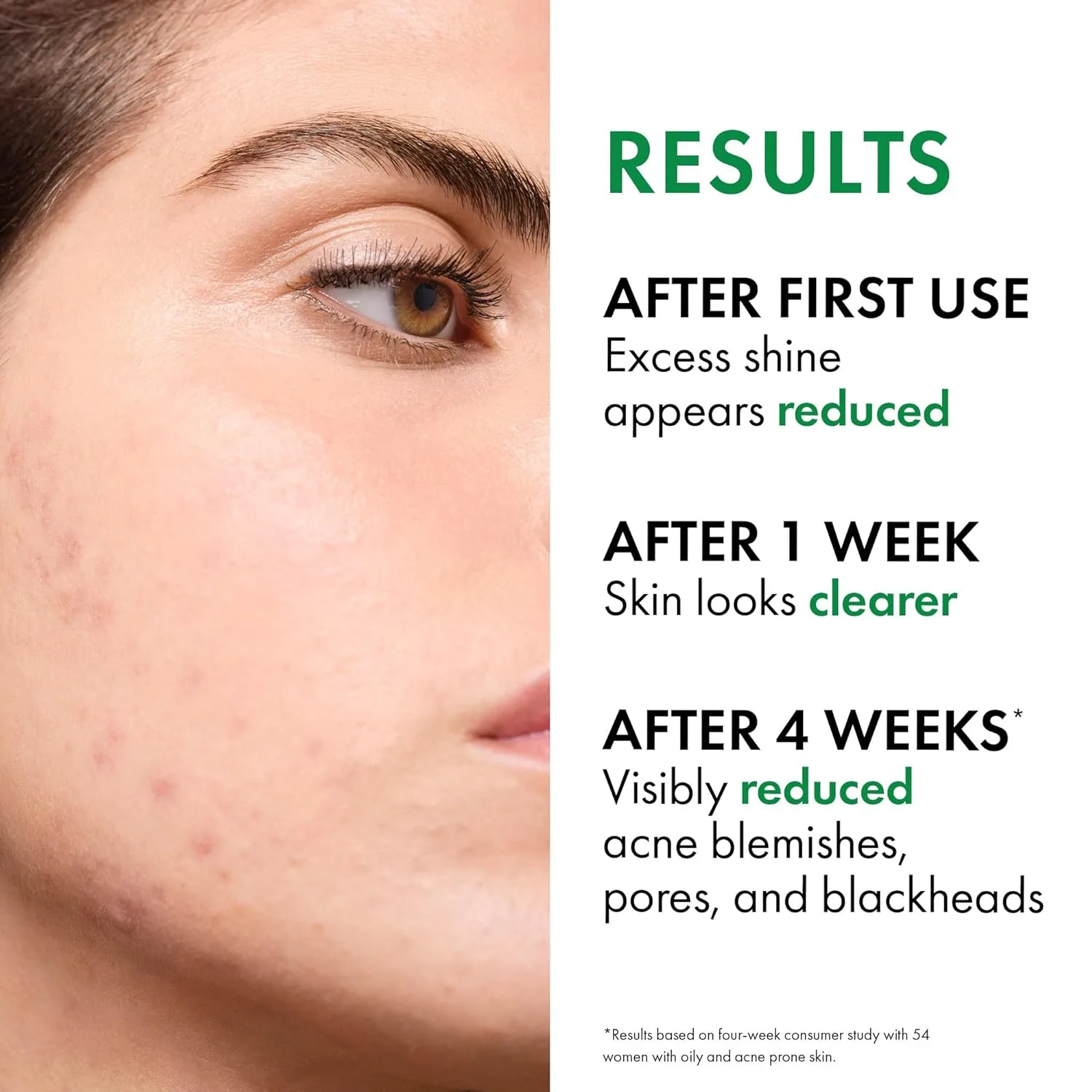Гель для умывания Vichy — Normaderm Daily Acne Face Wash, очищающее средство для лица с салициловой кислотой для, 400 мл — фото 4