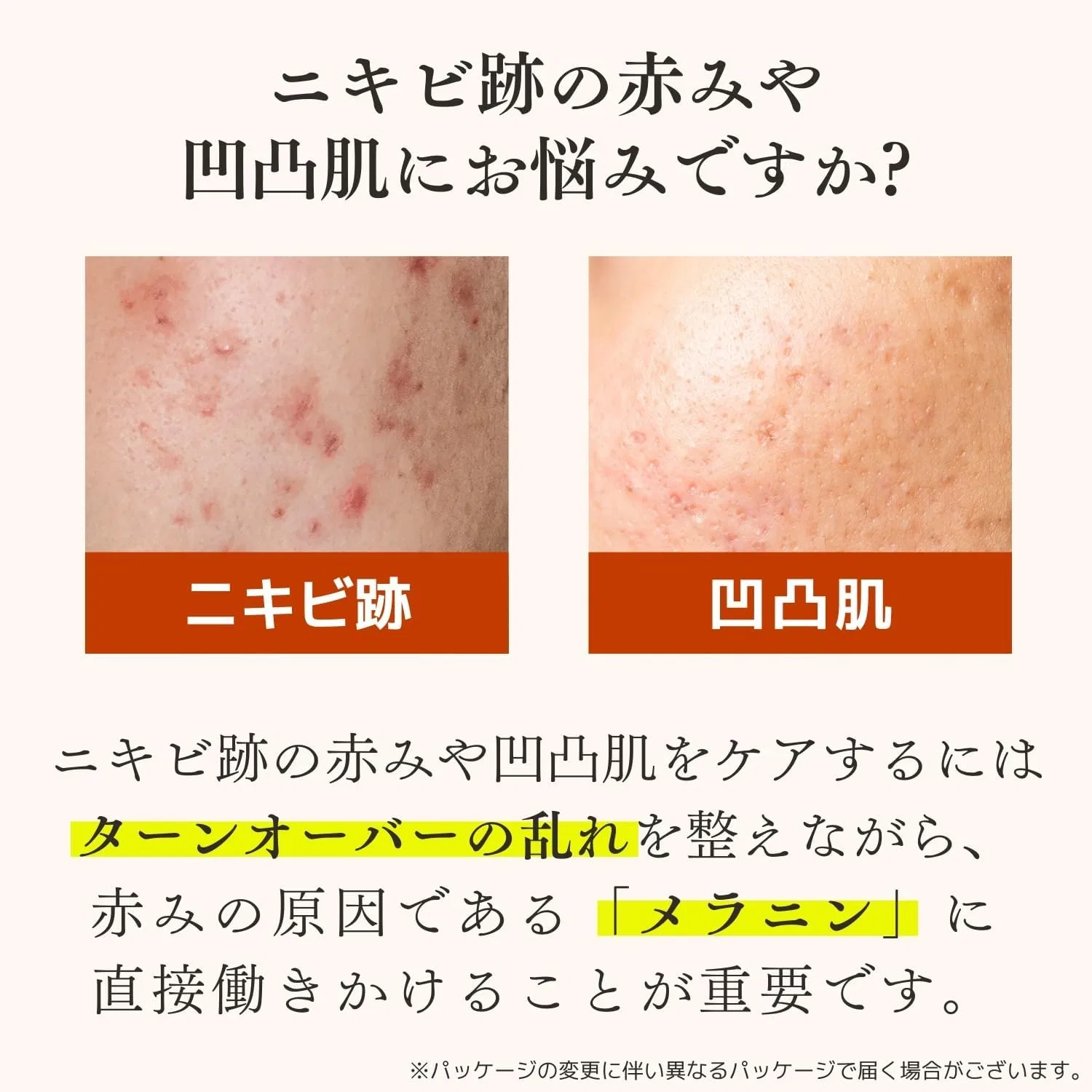 Набор для ухода за кожей Acne Care Dr. Re9 из 5 средств, 30 дней Doctor Re9 — фото 2