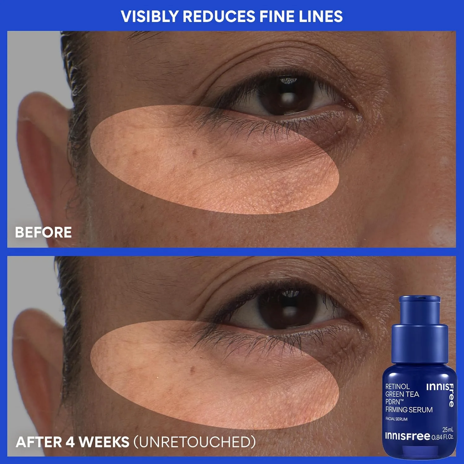 Укрепляющая сыворотка innisfree Green Tea Retinol PDRN - веганский корейский уход за кожей для разглаживания мелких морщин и улучшения текстуры кожи, доступна в подарочном наборе., Green — фото 4