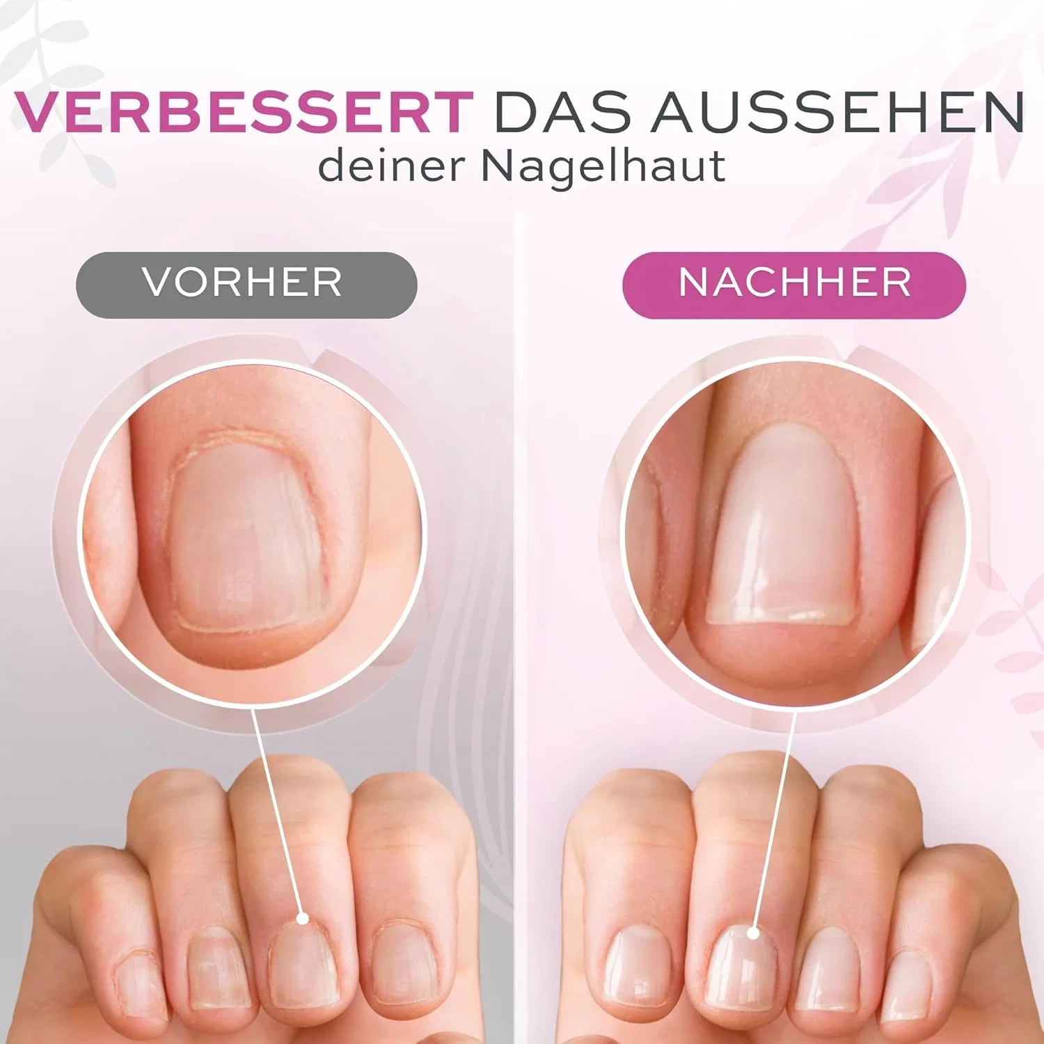 Набор профессиональных масел для кутикулы от Pics Nails Pics Nails — фото 4