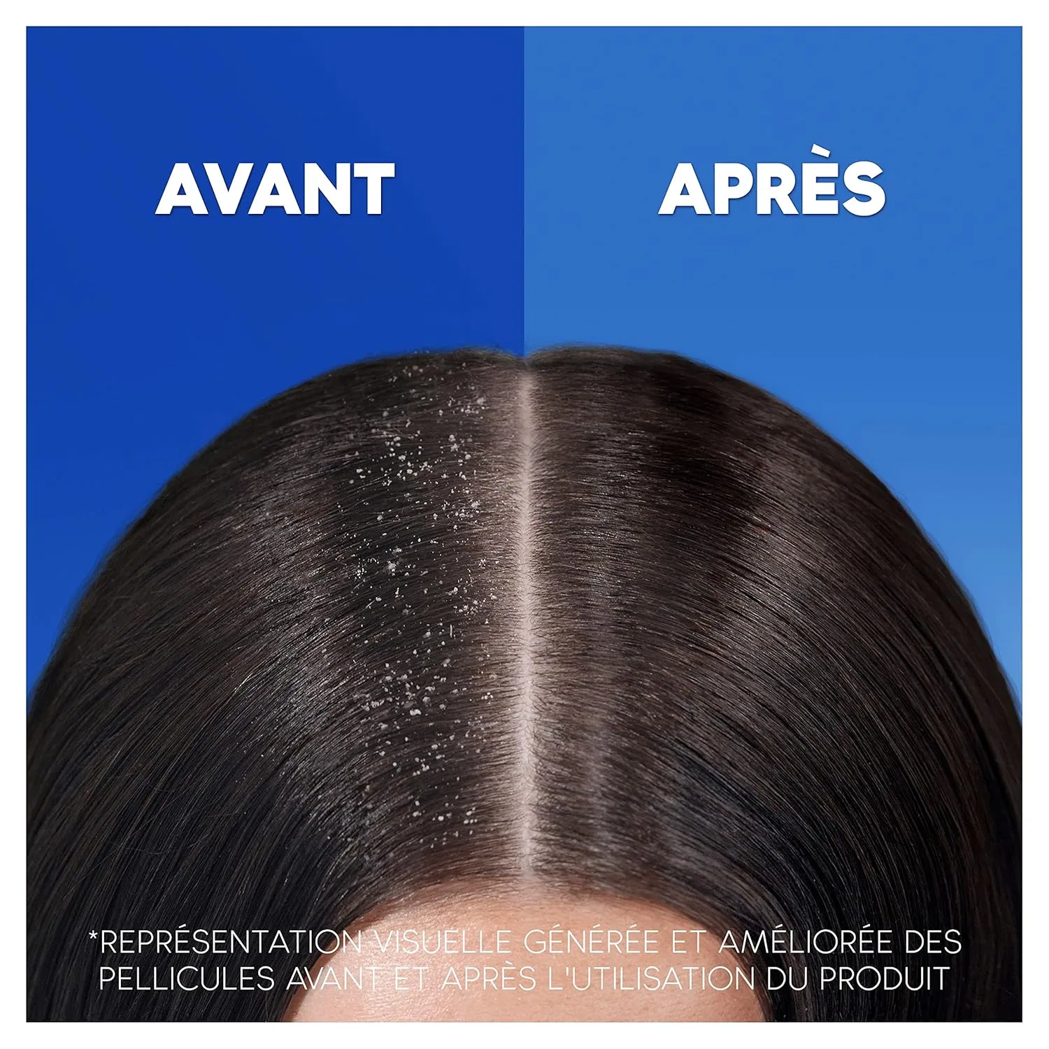 Шампунь-кондиционер 2-в-1 Head & Shoulders Sensitive Care против перхоти ‎Head & Shoulders — фото 3