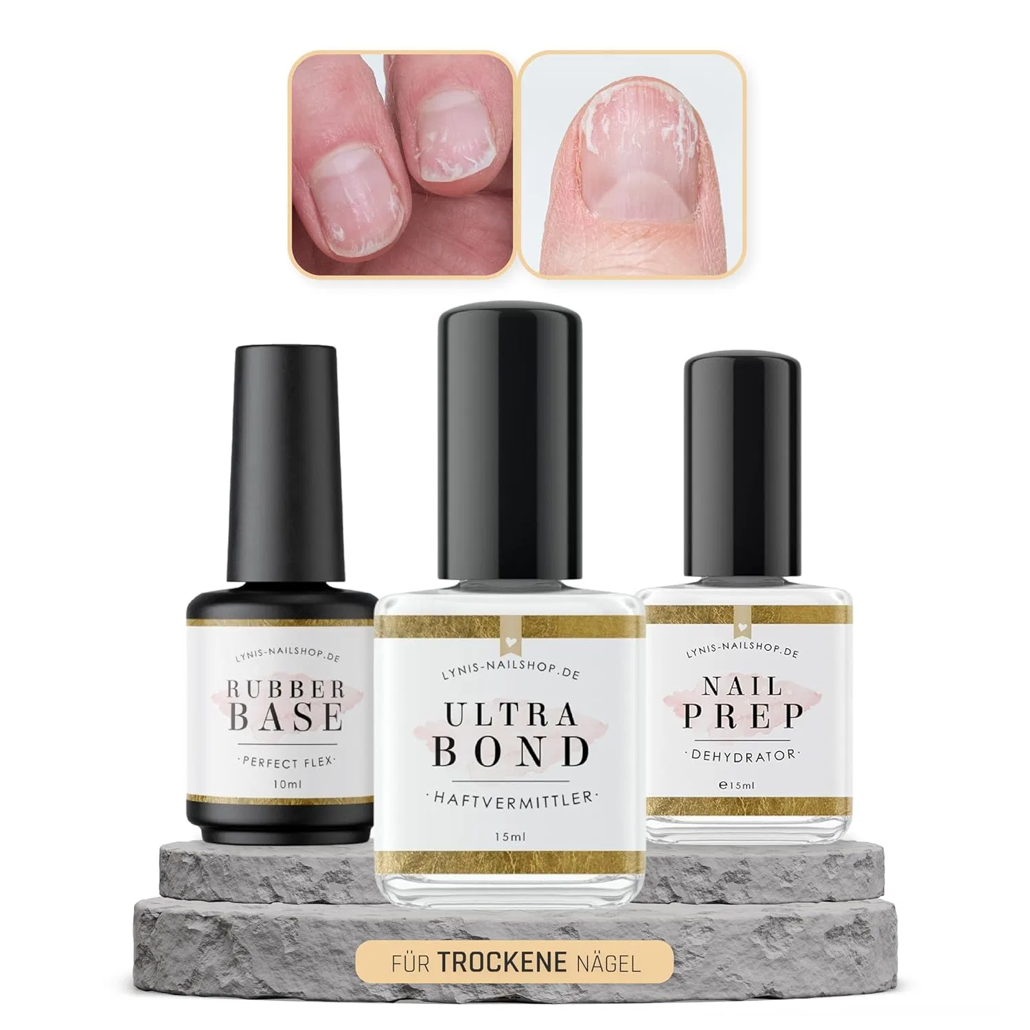 Набор для сцепления Lynis-Nailshop.de Ultra Bond для сухих ногтей Lynis Nailshop