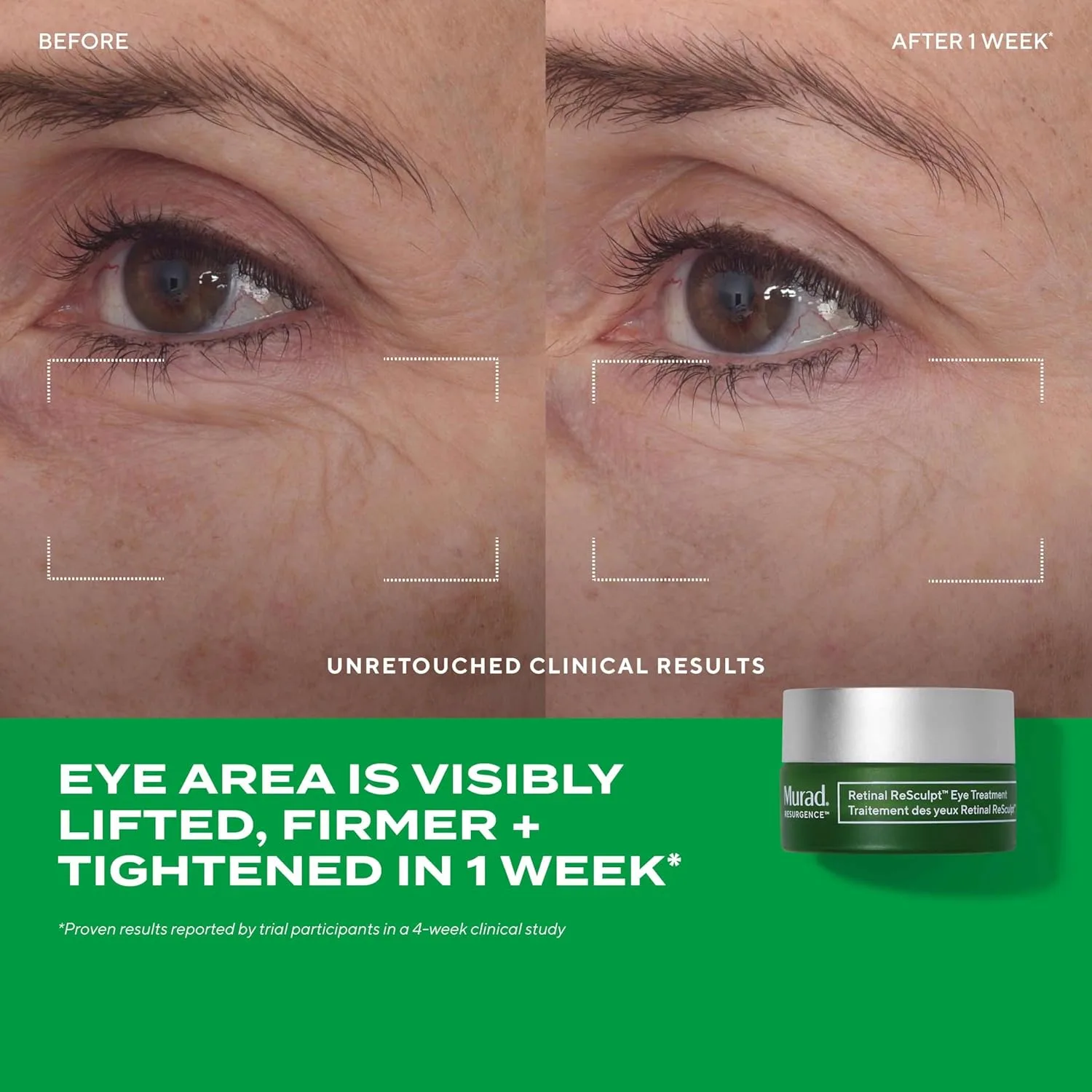 Антивозрастной набор Murad Retinal Trial Kit, для лифтинга и контурирования, с ретиналем, 2 предмета, прозрачный — фото 4