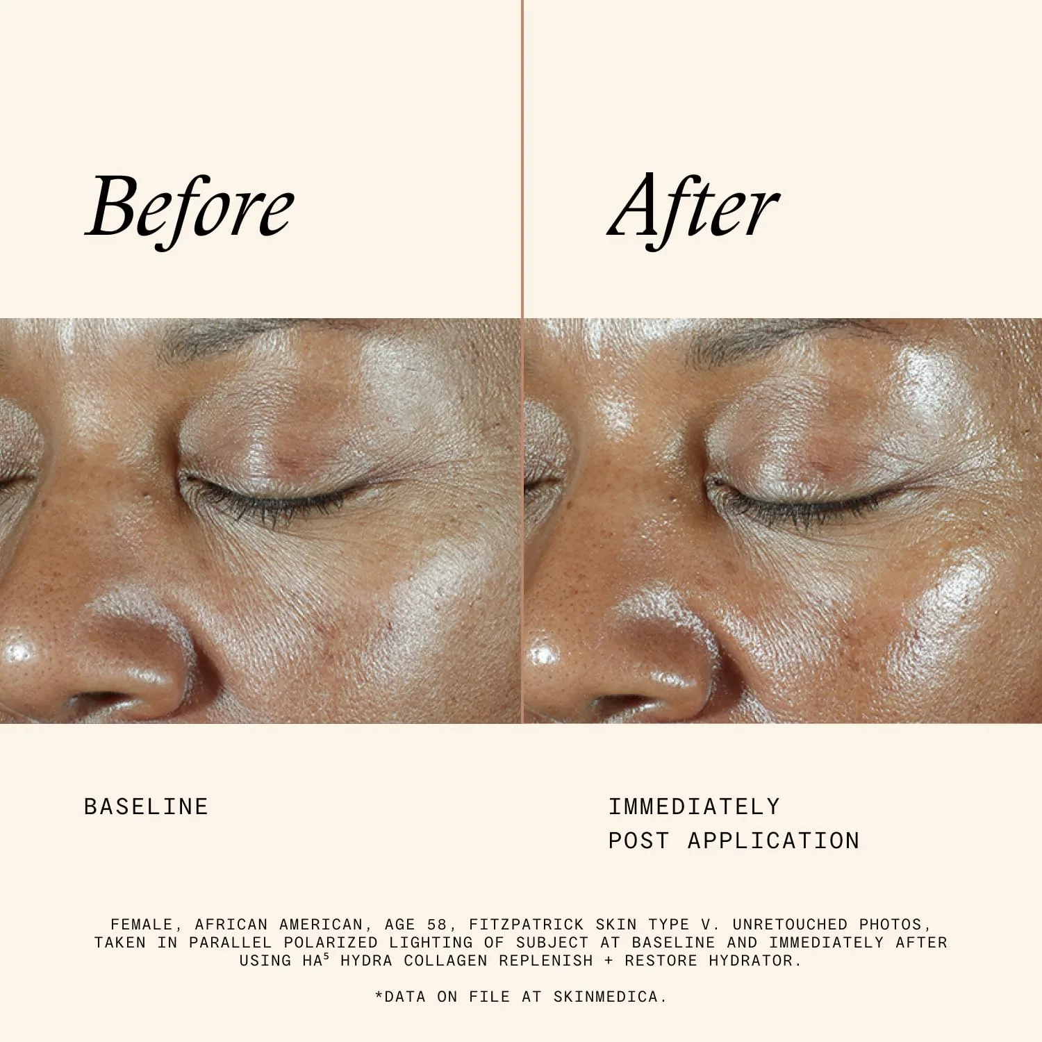 Сыворотка Skinmedica — HA5 Hydra Collagen Hydrator с веганским коллагеном (НОВАЯ УПАКОВКА), омолаживающий уход, 43 мл — фото 4