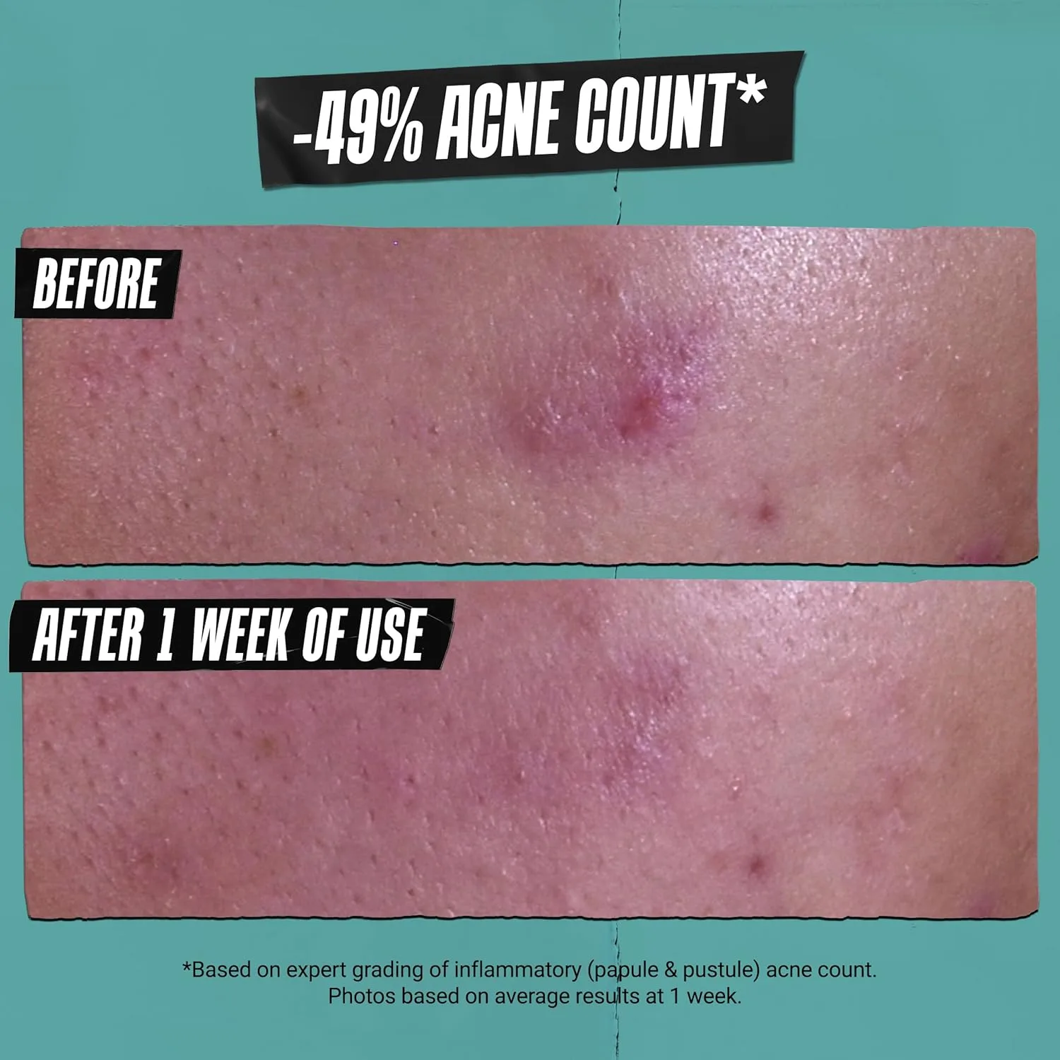 Маска для лица Kiehl's — Kiehl’s Acne-Treating Cleansing Paste с салициловой кислотой, многофункциональное, 124 мл — фото 4