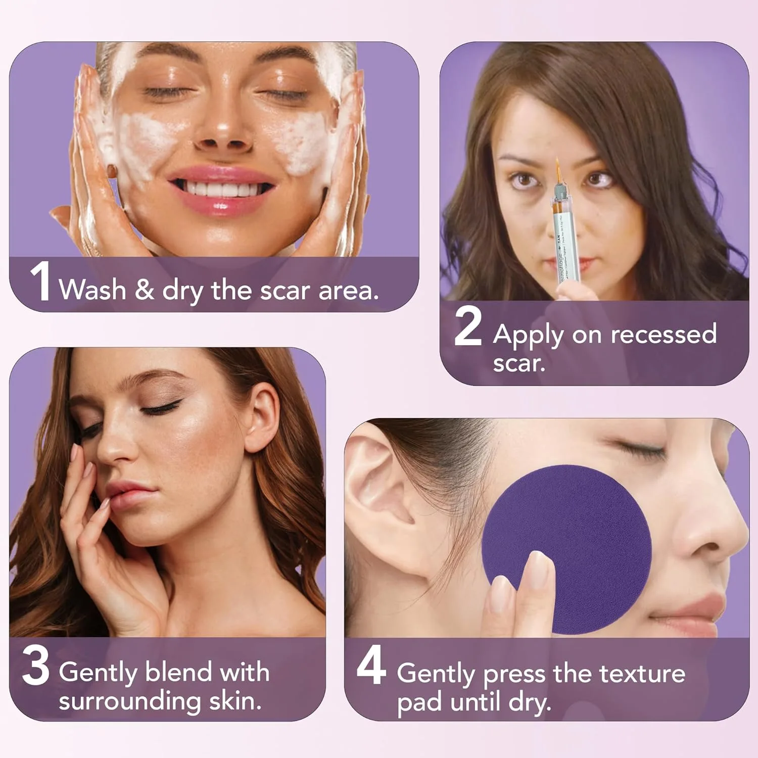Набор для заполнения рубцов Dermaflage Scar Filler Kit - Tan - Глубокое маскирование рубцов и водостойкий консилер для рубцов от акне, морщин и рубцов типа «ледяной иглы», запас на 1 месяц., Tan — фото 4