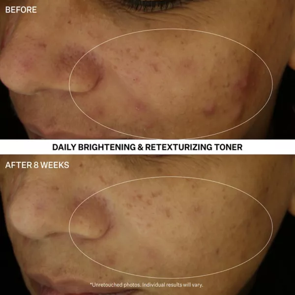 Тоник StriVectin — Многофункциональный прозрачный нежный ежедневный осветляющий и восстанавливающий для кожи — фото 3