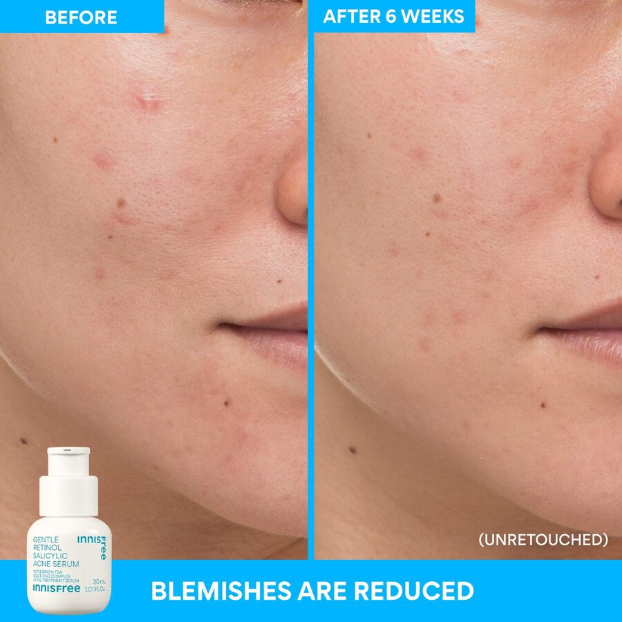 Тоник Innisfree — Мягкая от акне с ретинолом и салициловой кислотой, 30 мл — фото 3