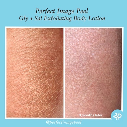 Лосьон для тела Gly 10% + Sal 2% Exfoliating Enhanced with Green Tea Papaya Bearberry Licorice Amino Complex — фото 3