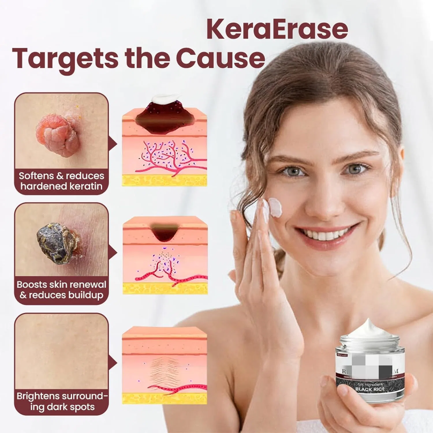 Крем для тела Biancat Keraerase Renewal Skin Treatment, 2 шт Generisch — фото 3