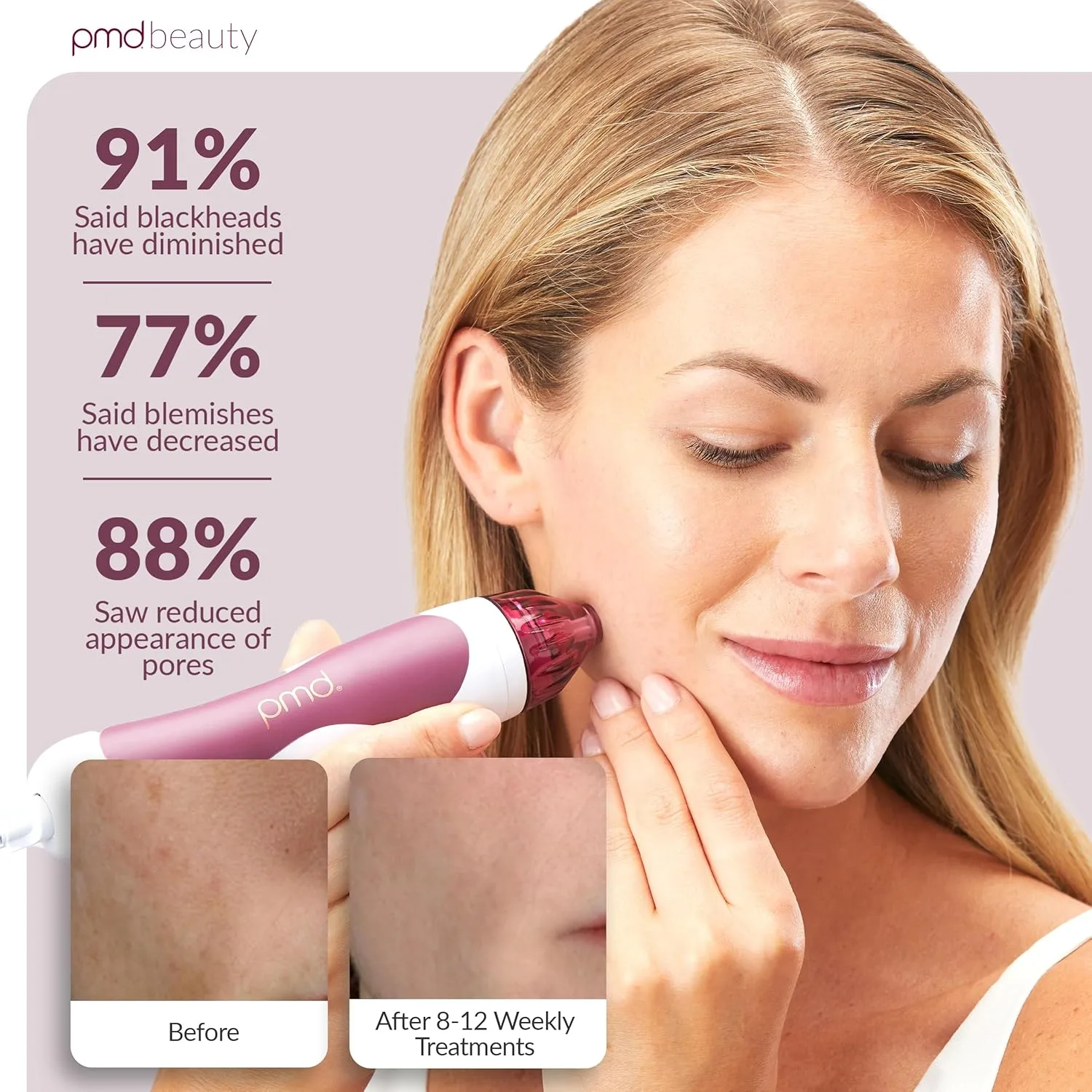 PMD Beauty Personal Microderm Classic - Набор для домашнего использования, инструмент для отшелушивания кожи лица, микродермабразия для ухода за кожей лица и тела., Berry — фото 4