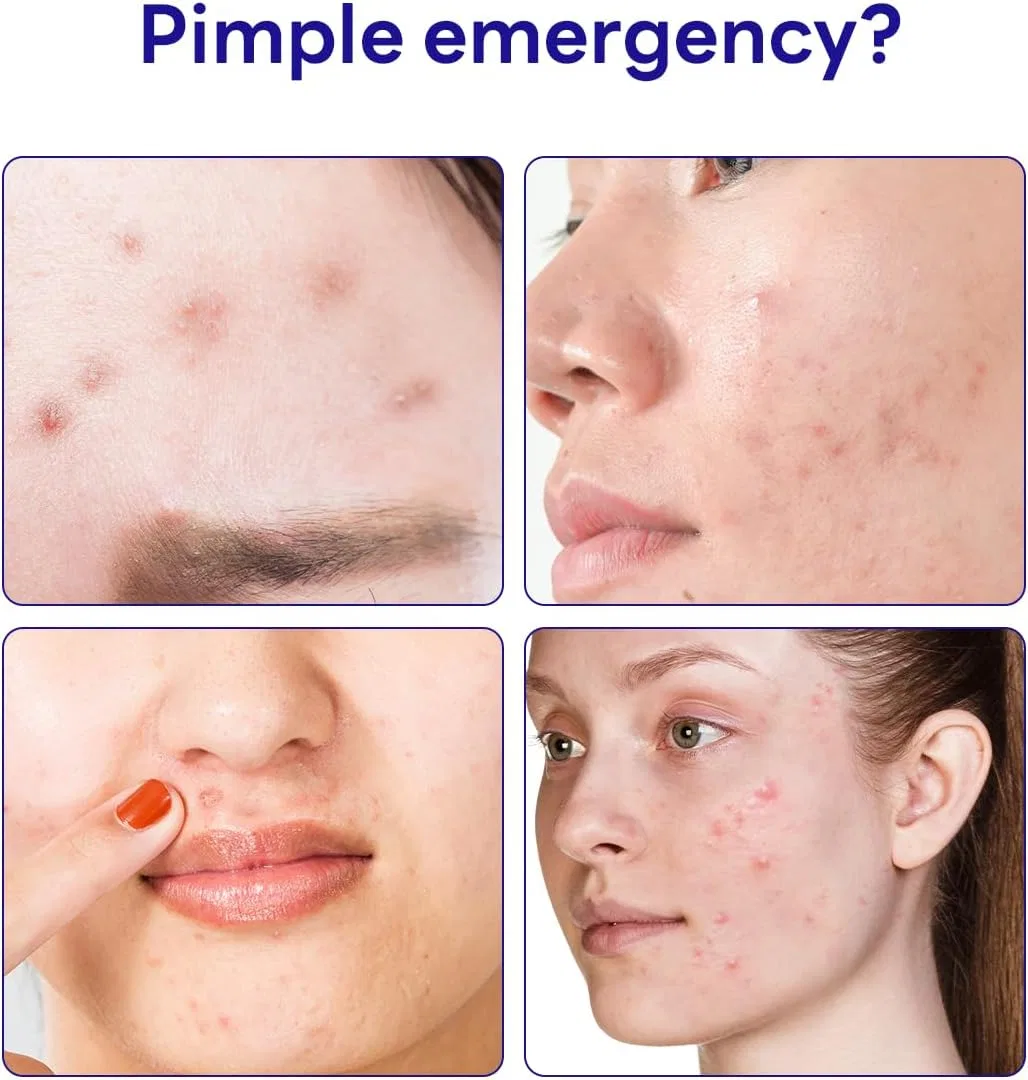 Патчи для лица MEDIHEAL Derma Clear Blemish Spot Patch с мадекассосидом, 44 шт — фото 2