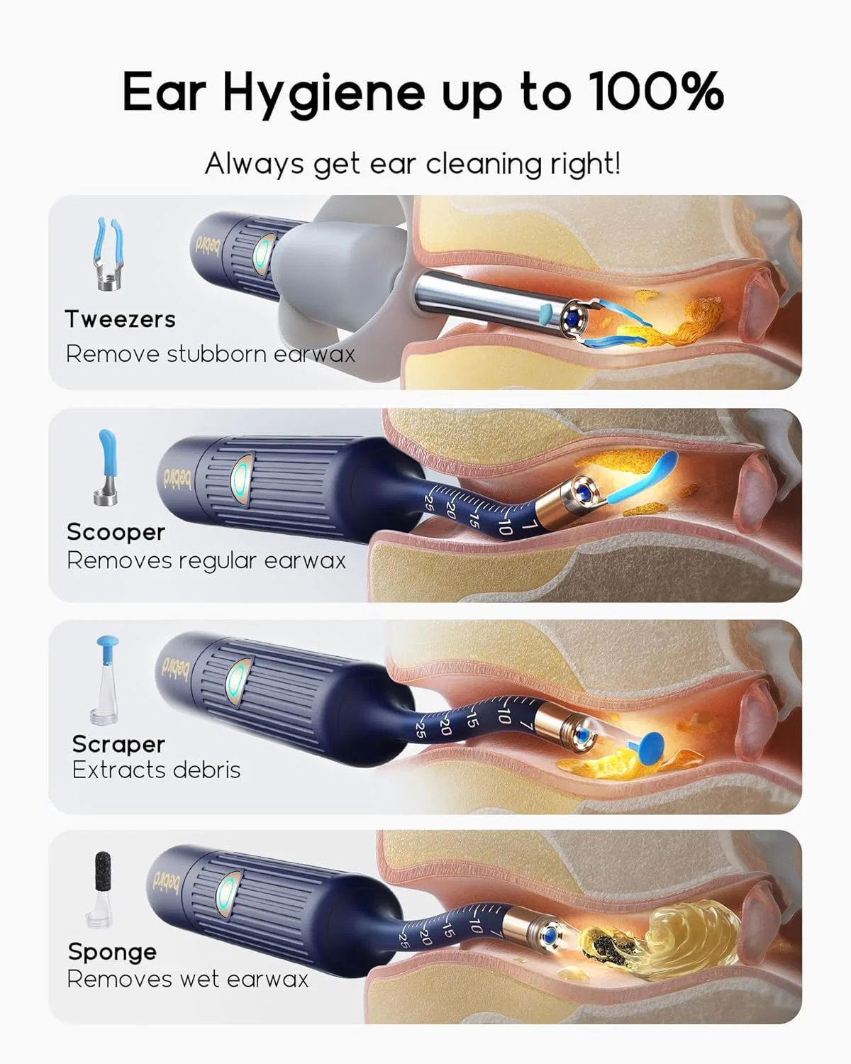 Набор для удаления серы из ушей Earsight Plus, беbirdpromax, темно-синий Bebirdpromax — фото 3