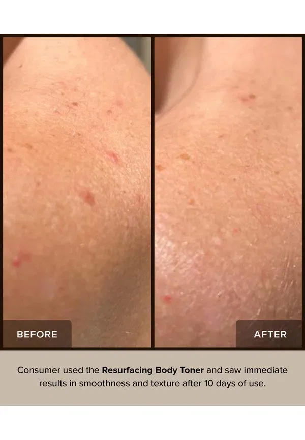 Тонер отшелушивающий Nudebody Resurfacing Body Toner Nudestix, 150 мл — фото 2