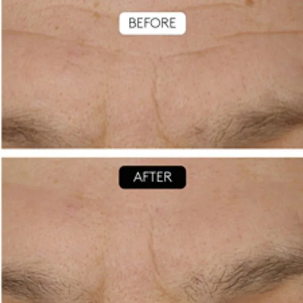 Средство для снятия макияжа Cocunat — Для лица Serum Clinical Beauty Filler — фото 3