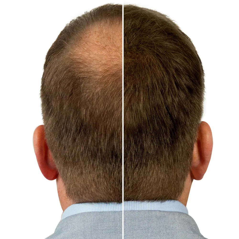 Эффективный загуститель для волос с витамином E, 25 г, черный Plus Additional Hair — фото 4