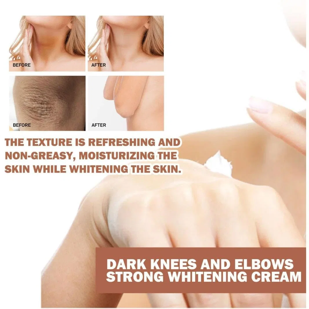 Крем для осветления кожи с Kojic Acid, 50 г Generisch — фото 3